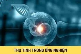 ảnh chủ đề