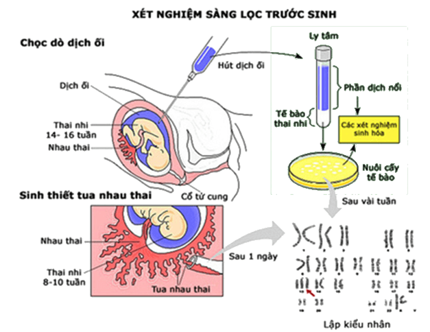 ảnh chủ đề